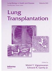 Lung Transplantation 1st Edition,1439802556,9781439802557