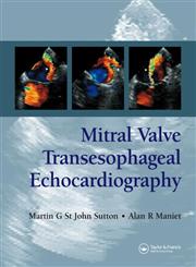 Mitral Valve Transesophageal Echocardiography,1841846082,9781841846088