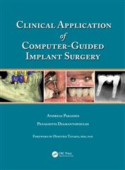 Clinical Application of Computer-Guided Implant Surgery 1st Edition,1482205416,9781482205411
