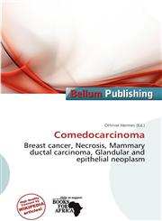 Comedocarcinoma,6139788366,9786139788361