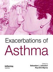 Exacerbations of Asthma 1st Edition,1842143182,9781842143186
