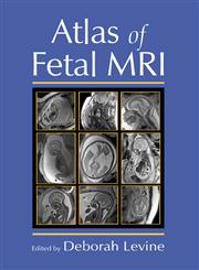 Atlas of Fetal MRI 1st Edition,0824725484,9780824725488