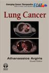 Lung Cancer,1936287528,9781936287529