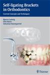 Self-Ligating Brackets in Orthodontics Current Concepts and Techniques 1st Edition,3131547014,9783131547019