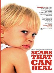 Scars That Can Heal Does every life have value?,1601450532,9781601450531