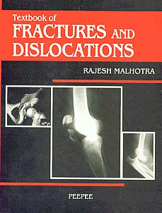 Textbook of Fractures and Dislocations 1st Edition,8188867578,9788188867578