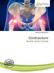 Contracture,6136523280,9786136523286