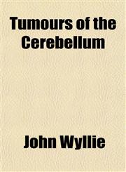 Tumours of the Cerebellum,1152088041,9781152088047