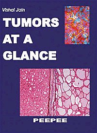 Tumors at a Glance 1st Edition,8188867160,9788188867165