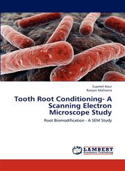 Tooth Root Conditioning- A Scanning Electron Microscope Study,3846520764,9783846520765