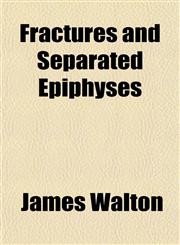 Fractures and Separated Epiphyses,1152543547,9781152543546