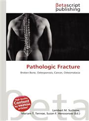 Pathologic Fracture,613356962X,9786133569621