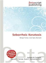 Seborrheic Keratosis,6137589528,9786137589526