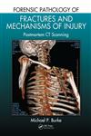 Forensic Pathology of Fractures and Mechanisms of Injury Postmortem CT Scanning 1st Edition,1439881480,9781439881484