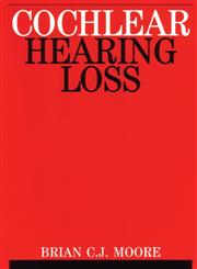 Cochlear Hearing Loss 1st Edition,1861560915,9781861560919