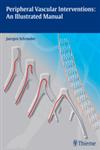 Peripheral Vascular Interventions An Illustrated Manual 1st Edition,3131697512,9783131697516