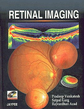 Retinal Imaging 1st Edition,8184481896,9788184481891