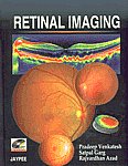 Retinal Imaging 1st Edition,8184481896,9788184481891