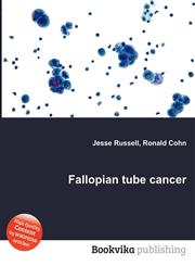 Fallopian Tube Cancer,5512596888,9785512596883