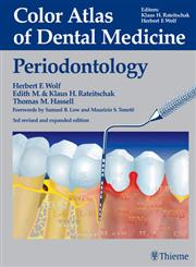 Color Atlas of Dental Medicine Periodontology 3rd Edition,3136750039,9783136750032