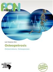 Osteopetrosis,6137968197,9786137968192