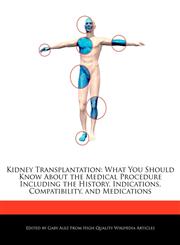 Kidney Transplantation What You Should Know About the Medical Procedure Including the History, Indications, Compatibility, and Medications,1276156758,9781276156752