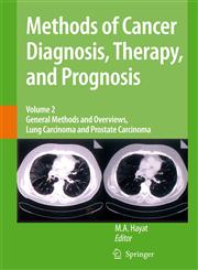 Methods of Cancer Diagnosis, Therapy and Prognosis General Methods and Overviews, Lung Carcinoma and Prostate Carcinoma,1402084412,9781402084416