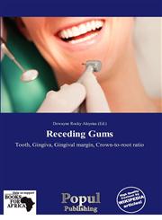 Receding Gums,6139245044,9786139245048