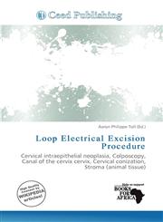 Loop Electrical Excision Procedure,6139800374,9786139800377