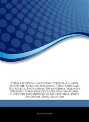 Articles On Drug Eruptions, including Stevensâ€"johnson Syndrome, Mercury Poisoning, Toxic Epidermal Necrolysis, Angioedema, Bromoderma, Warfarin Necrosis, Drug-induced Lupus Erythematosus, Chemotherapy-induced Acral Erythema,1243420847,9781243420848