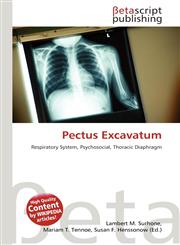 Pectus Excavatum,6135280651,9786135280654