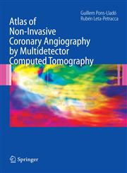 Atlas of Non-Invasive Coronary Angiography by Multidetector Computed Tomography 1st Edition,0387330445,9780387330440