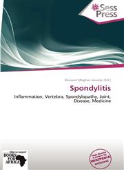 Spondylitis,6138678702,9786138678700