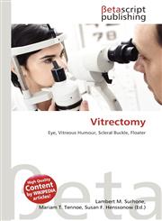 Vitrectomy,6130952961,9786130952969