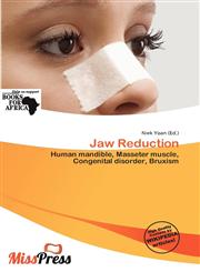 Jaw Reduction,6200374368,9786200374363