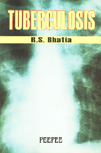 Tuberculosis 1st Edition, Reprint,8188867985,9788188867981