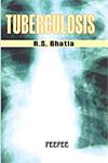 Tuberculosis 1st Edition, Reprint,8188867985,9788188867981