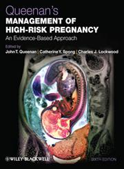 Queenan's Management of High-Risk Pregnancy An Evidence-Based Approach 6th Edition,0470655763,9780470655764