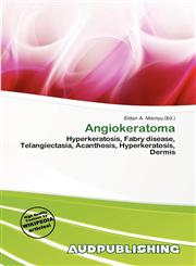 Angiokeratoma,6139743818,9786139743810