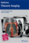 Thoracic Imaging 1st Edition,1604061871,9781604061871