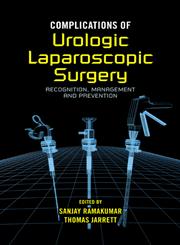 Complications of Urologic Laparoscopic Surgery 1st Edition,0824726596,9780824726591
