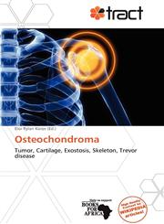 Osteochondroma,613796647X,9786137966471