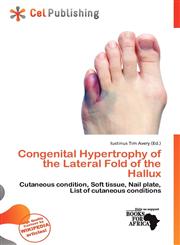 Congenital Hypertrophy of the Lateral Fold of the Hallux,6200559392,9786200559395