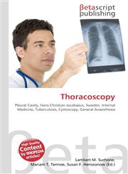 Thoracoscopy,6130424744,9786130424749