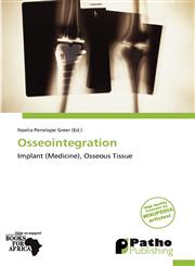 Osseointegration,6137955095,9786137955093