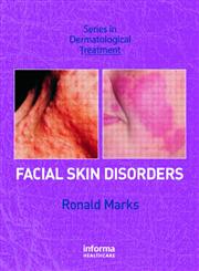 Facial Skin Disorders,1841842109,9781841842103