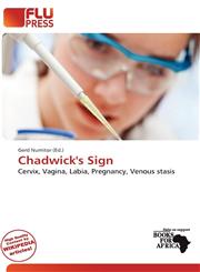 Chadwick's Sign,6200503109,9786200503107