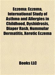 Eczema International Study of Asthma and Allergies in Childhood, Dyshidrosis, Diaper Rash, Nummular Dermatitis, Xerotic Eczema,1155665848,9781155665849