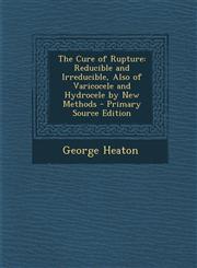 Cure of Rupture Reducible and Irreducible, Also of Varicocele and Hydrocele by New Methods,1289548870,9781289548872