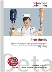 Prosthesis,6130315902,9786130315900